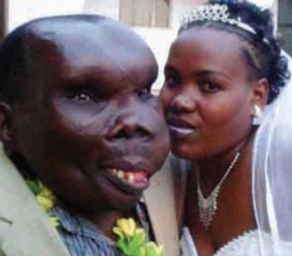 Wygląda strasznie? Najbrzydszy mężczyzna w Ugandzie. Nie uwierzycie jak wygląda jego żona!