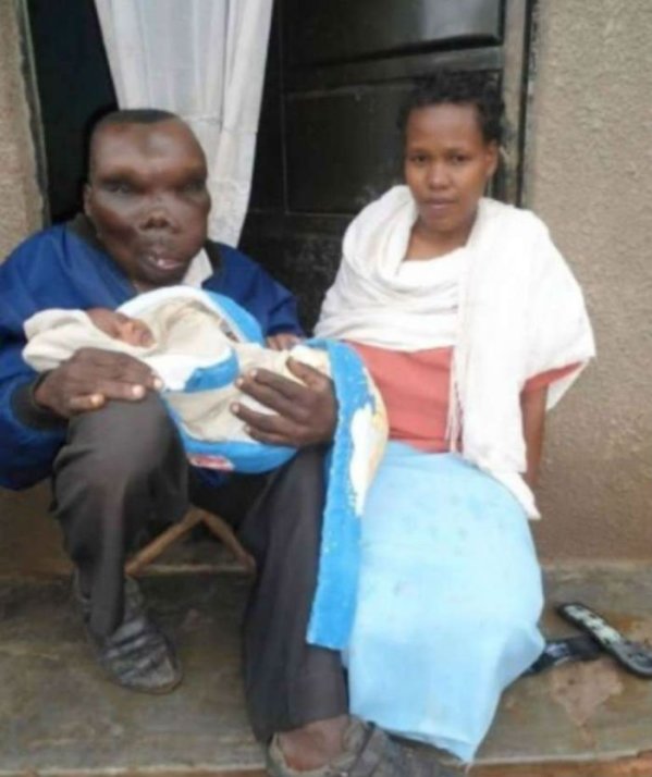 Wygląda strasznie? Najbrzydszy mężczyzna w Ugandzie. Nie uwierzycie jak wygląda jego żona!